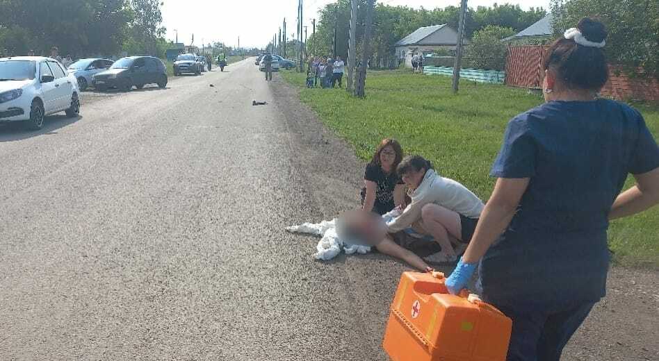 Девушка на самокате из  с. Красная Башкирия умерла в реанимации