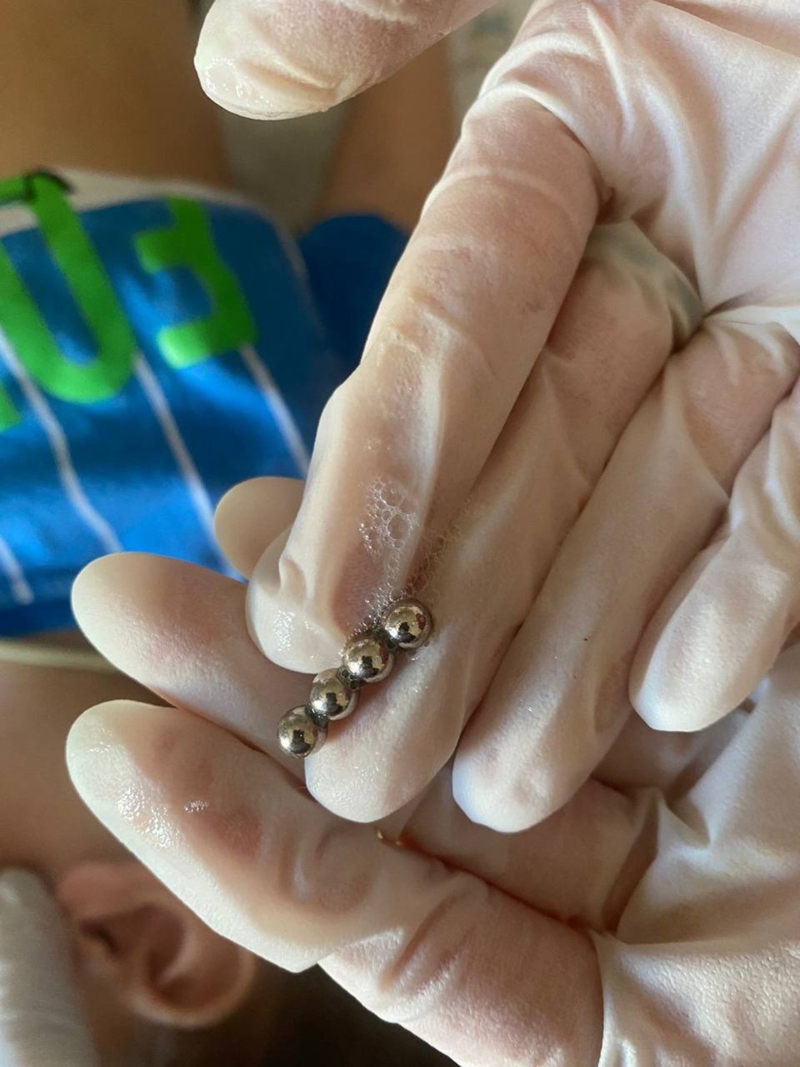 В Уфе хирурги извлекли из желудка малыша шесть магнитных шариков